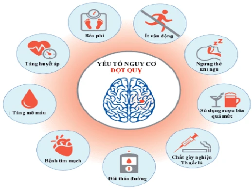 25% Bệnh Nhân Đột Quỵ Sẽ Tái Phát Trong 5 Năm Nếu Không Được Dự Phòng