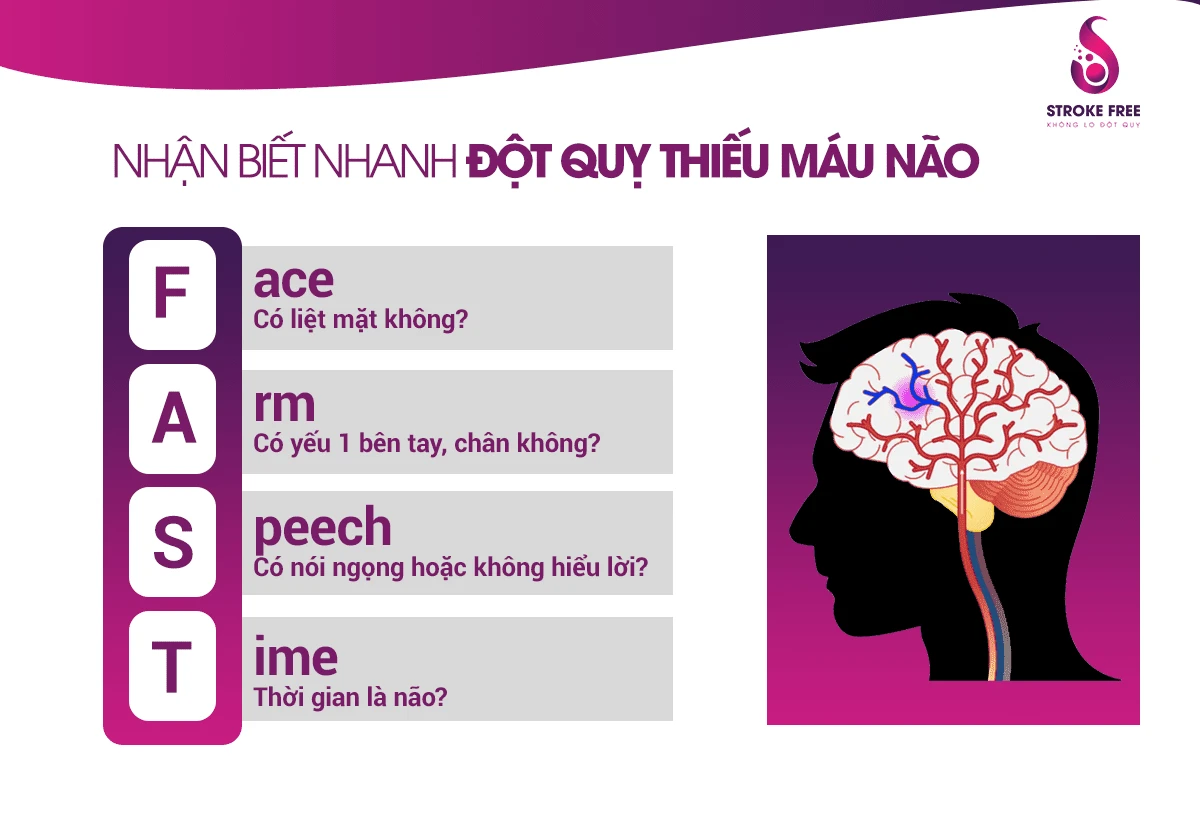 Chuẩn Đoán Rung Nhĩ Và Nhận Biết Đột Quỵ Thiếu Máu Não Như Thế Nào?