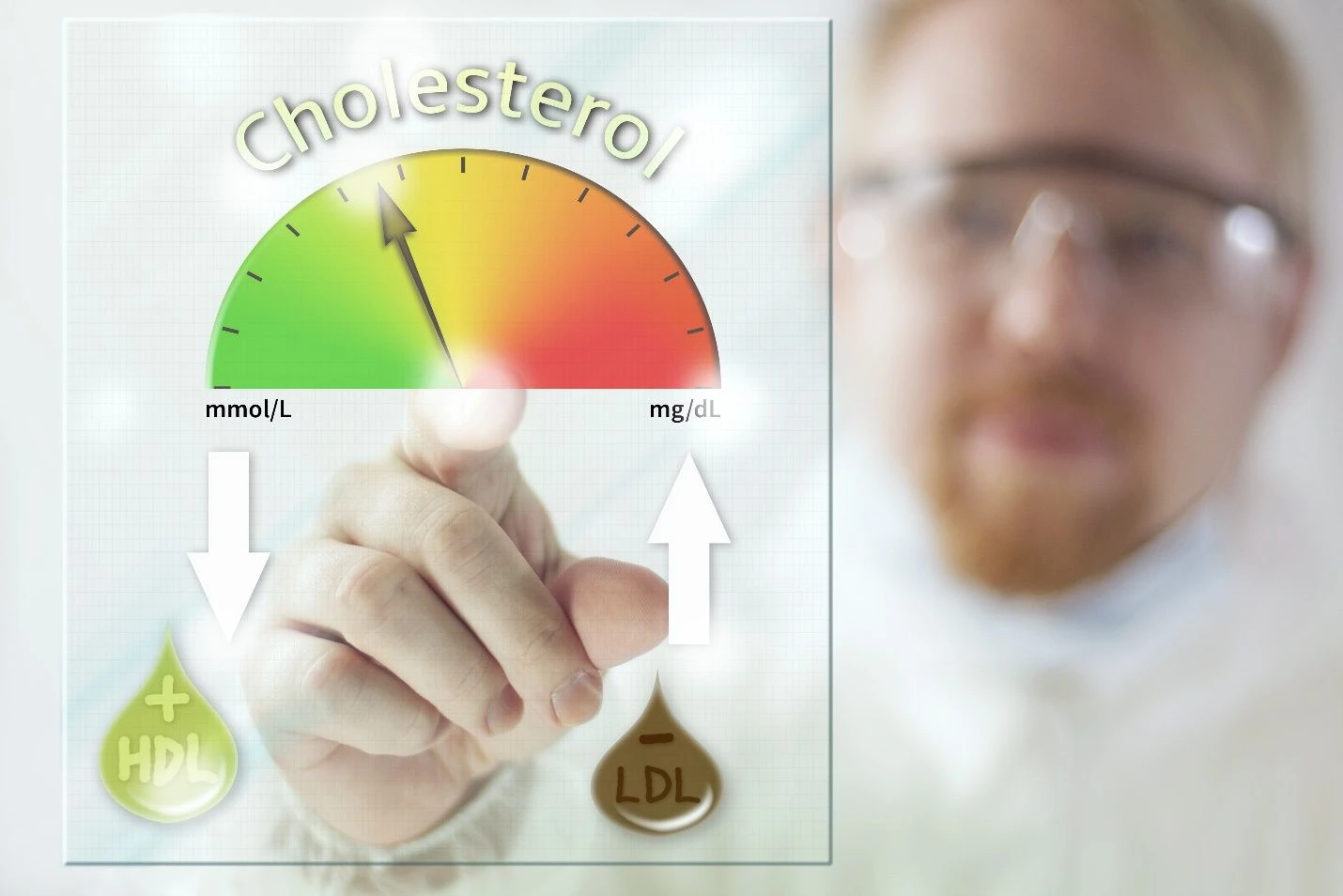 Đột Quỵ Do Không Kiểm Soát Cholesterol Xấu