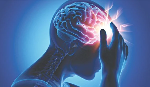 Phân Loại Đột Quỵ